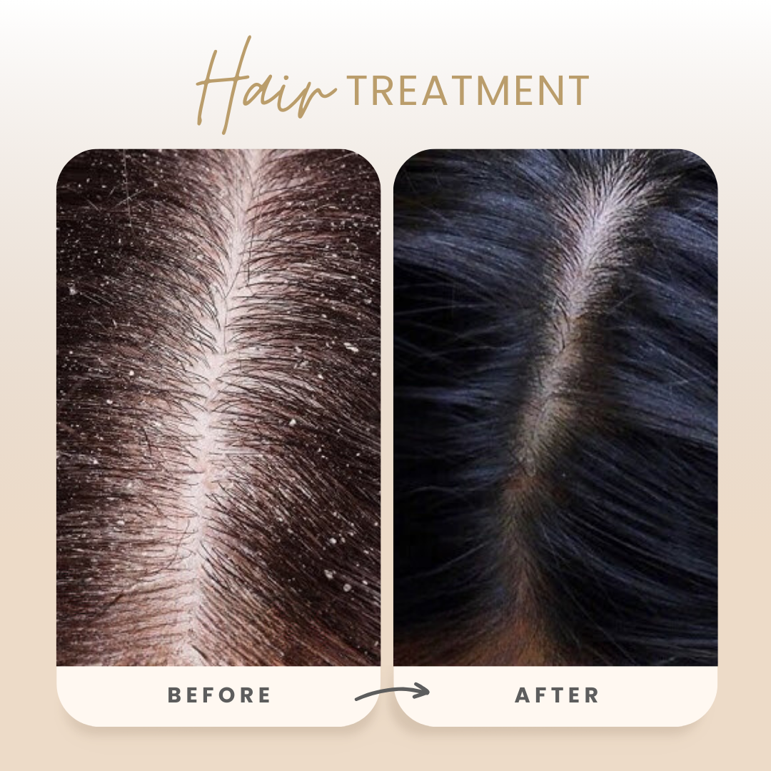 Rijuh’s Anti-Dandruff Herbal Shampoo