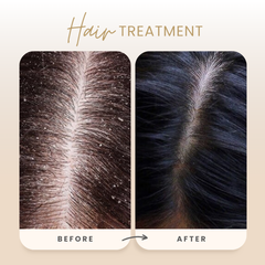 Rijuh’s Anti-Dandruff Herbal Shampoo